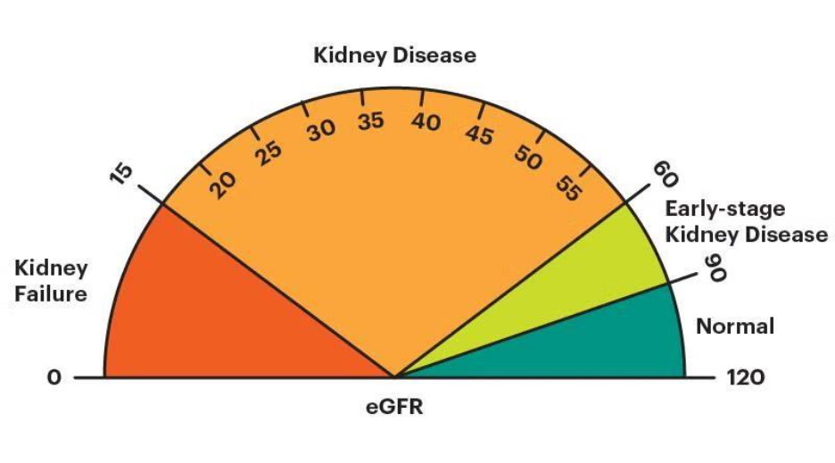EGFR calculator