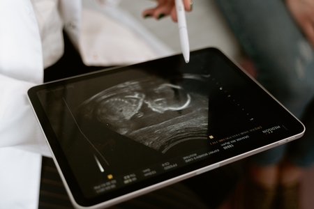 Doctor looking at an ultrasound scan